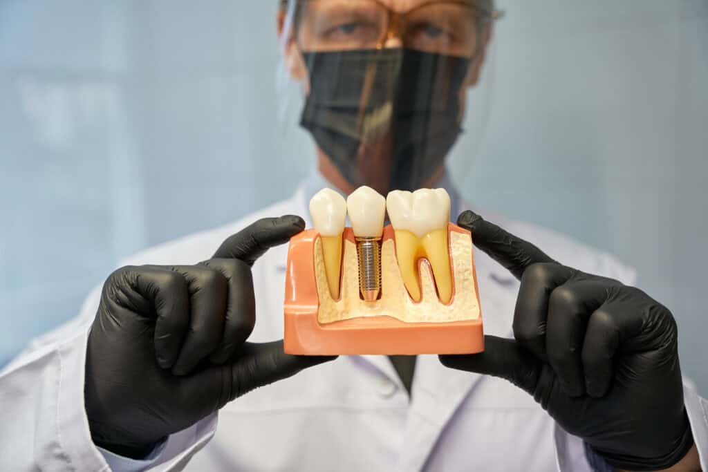 Serious dentist in protective gear holding a dental implant model, illustrating restorative dentistry and dental implants for missing teeth solutions.
