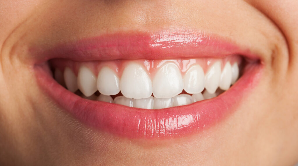 Professional teeth whitening results with a bright white smile after cosmetic dental treatment in Owings Mills, MD.