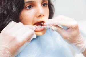 Teen patient receiving a clear dental aligner during an orthodontic appointment.